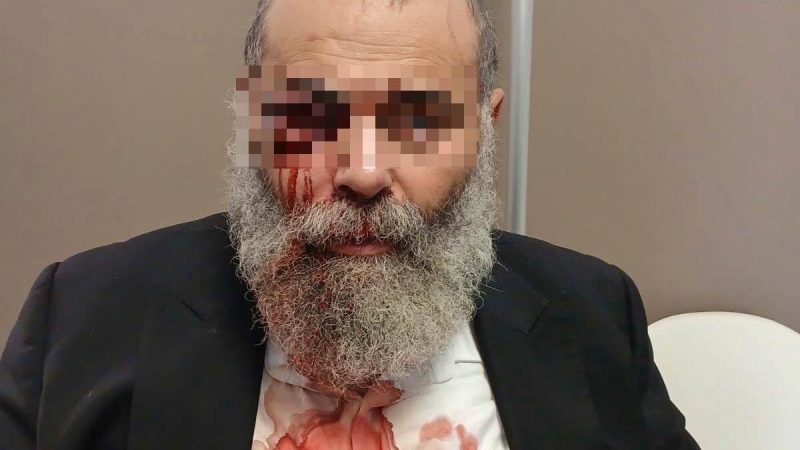 Agression violente à Yerres (Essonne) : un homme portant une kippa agressé sous des menaces antisémites