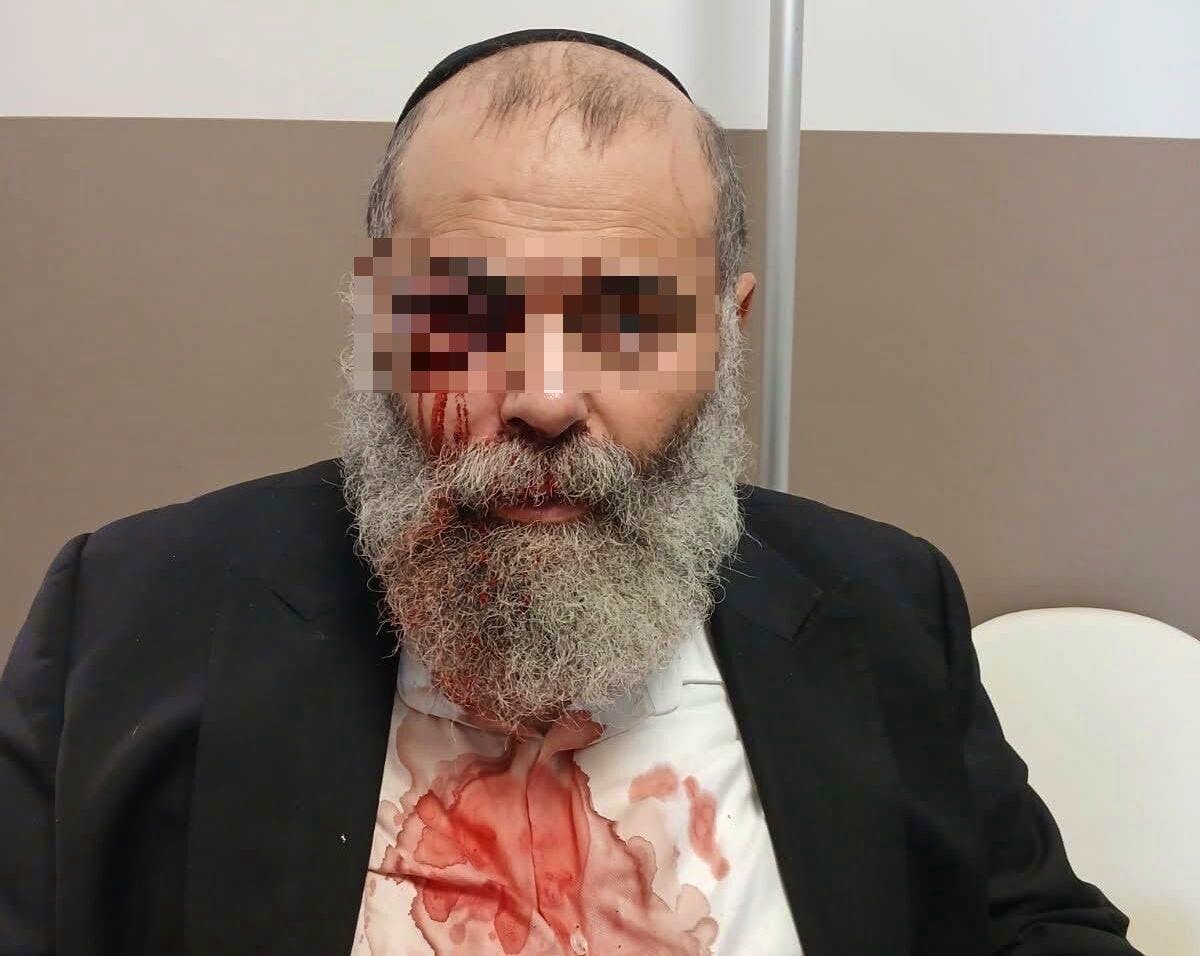 Agression violente à Yerres (Essonne) : un homme portant une kippa agressé sous des menaces antisémites